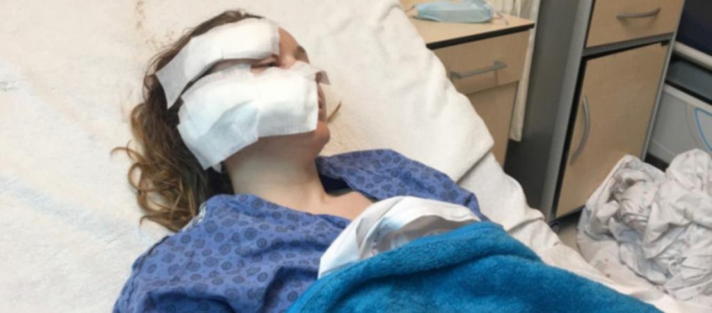 Τουρκία: Χάραξε το πρόσωπο της συντρόφου του επειδή του ζήτησε διαζύγιο (βίντεο)