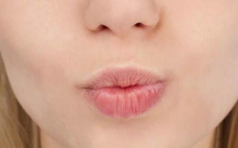 Σκασμένα χείλη: Πώς να τα περιποιηθείς τον χειμώνα