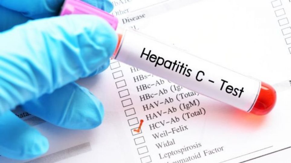 Ηπατίτιδα C: Συμπτώματα και ποιοι κινδυνεύουν περισσότερο (βίντεο)