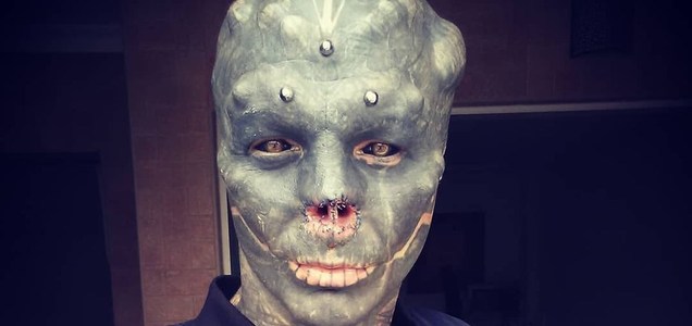 Anthony Loffredo: Ο 32χρονος άντρας που αφαίρεσε τη μύτη και το πάνω χείλος για να γίνει… «μαύρος εξωγήινος» (φωτό)