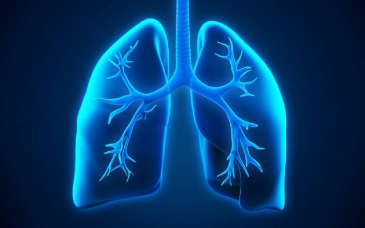 Πνευμονικό απόστημα: Τι είναι και με ποια συμπτώματα εκδηλώνεται