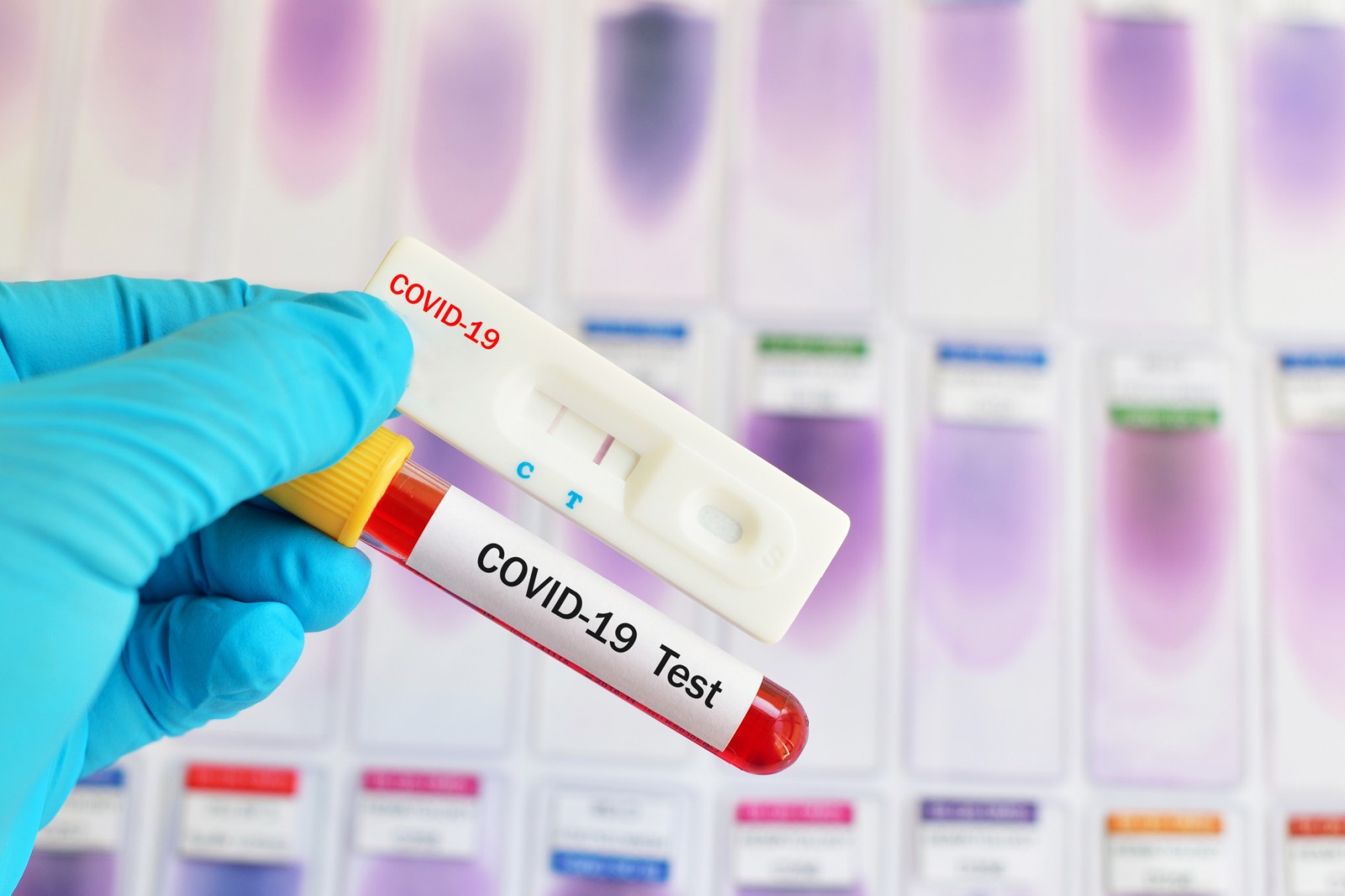 ΕΟΔΥ: 25 κρούσματα κορωνοϊού διαγνώσθηκαν χθες σε 2.265 rapid test