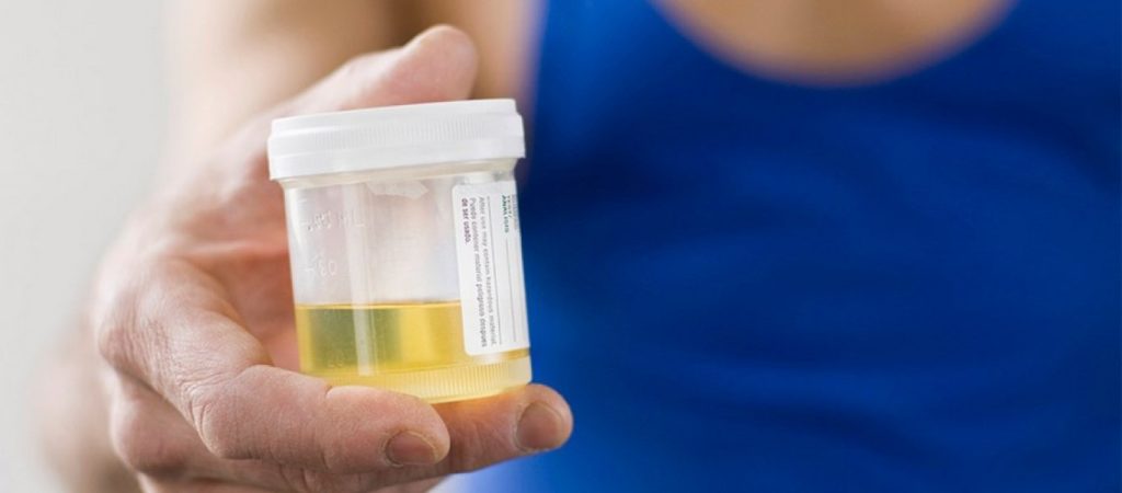 Ούρα: Ποια προβλήματα υγείας επηρεάζουν το χρώμα τους