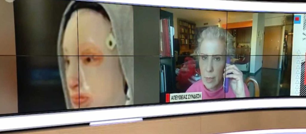 Επίθεση με βιτριόλι: Ο λόγος που φορά ειδική μάσκα η Ιωάννα – Όσα είπε η γιατρός της