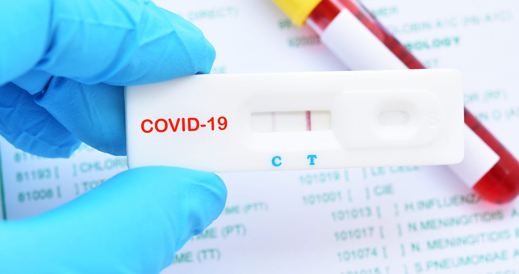 ΕΟΔΥ: Στα 8.836 rapid test εντοπίστηκαν 154 θετικά κρούσματα κορωνοϊού