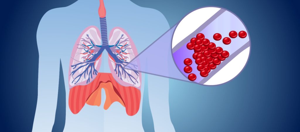Σημαντικός παράγοντας για την εμφάνιση θρόμβωσης ο κορωνοϊός – Όσα πρέπει να προσέξετε