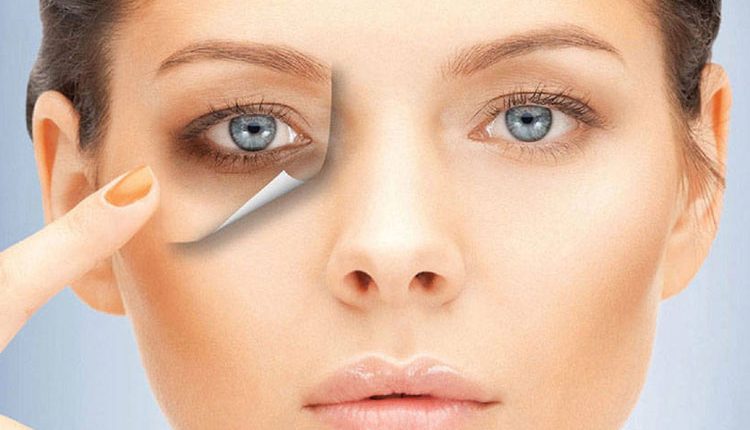 Πείτε «αντίο» στους μαύρους κύκλους με αυτό το απόλυτο γιατρικό