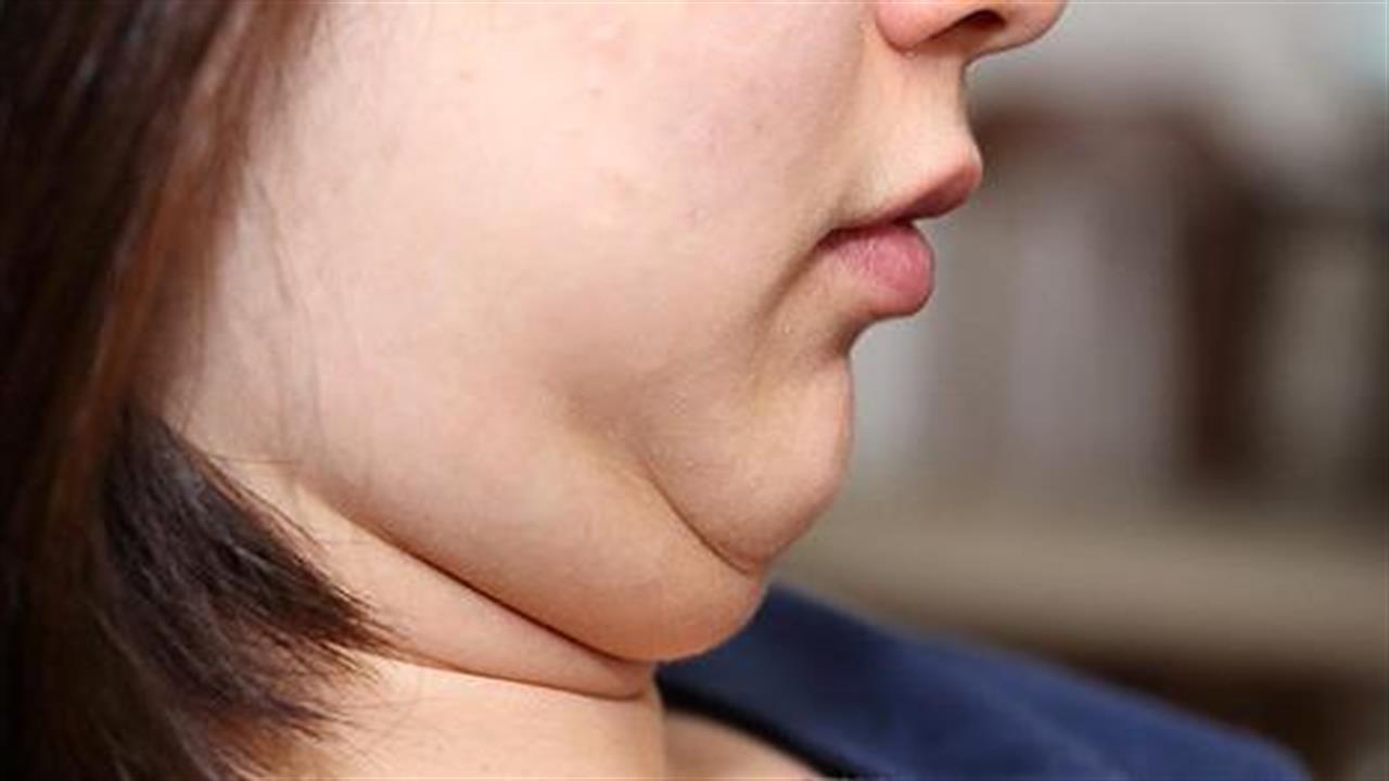 Λίπος στο πρόσωπο: Tι να κάνετε για να το αντιμετωπίσετε