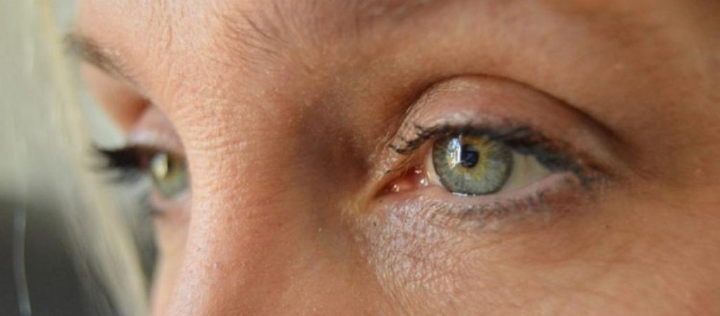 Έρπης στα μάτια: Ποια τα συμπτώματα και πως να τον αντιμετωπίσετε