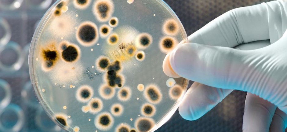 Τριχομονάδες: Το νου σας σε αυτά τα «ύπουλα» συμπτώματα – Ποια είναι σε γυναίκες και άντρες