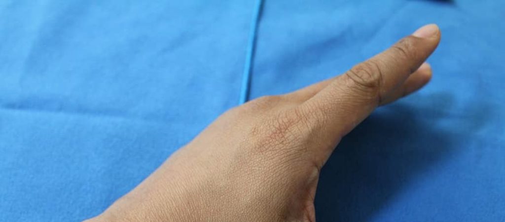 Πρωτόγνωρο περιστατικό για γιατρούς – Άνδρας έβγαλε διπλό νύχι στο δάχτυλο του χεριού του (φώτο)