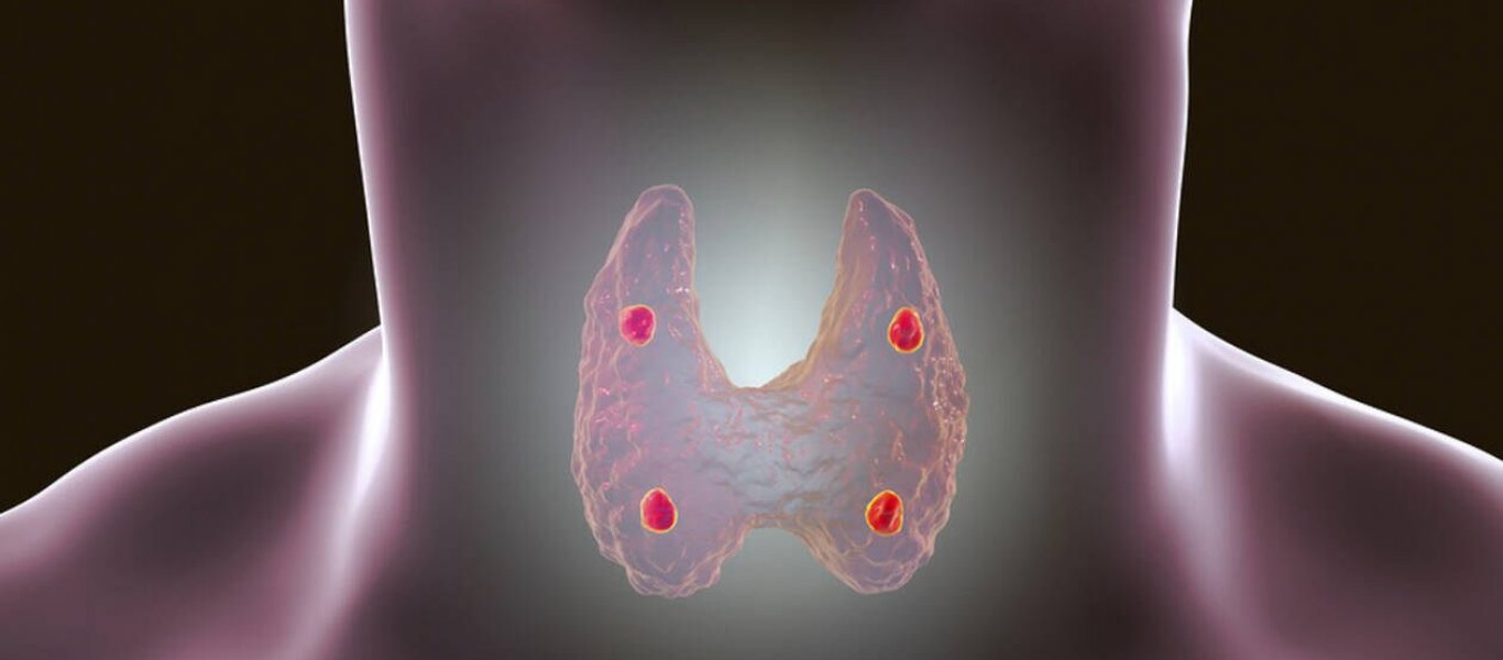 Υποθυρεοειδισμός: Δείτε ποιες είναι οι τροφές που πρέπει να τρώτε & ποιες όχι