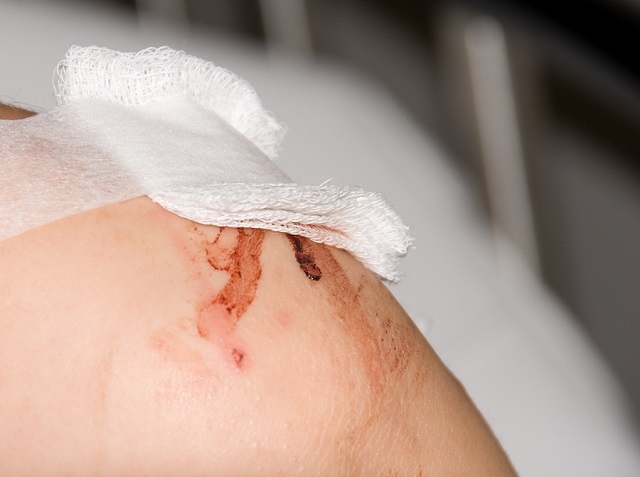 Θα σας «σώσουν»: Αυτά είναι τα τέσσερα καλύτερα γιατροσόφια για πληγές και κοψίματα