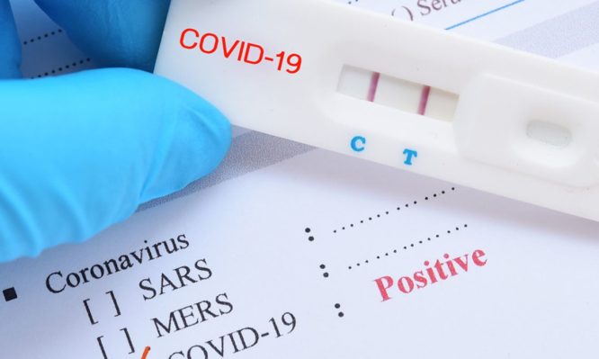 Πώς θα γίνεται η παραλαβή και η διενέργεια των self test – Ποιοι θα τα πάρουν πρώτοι