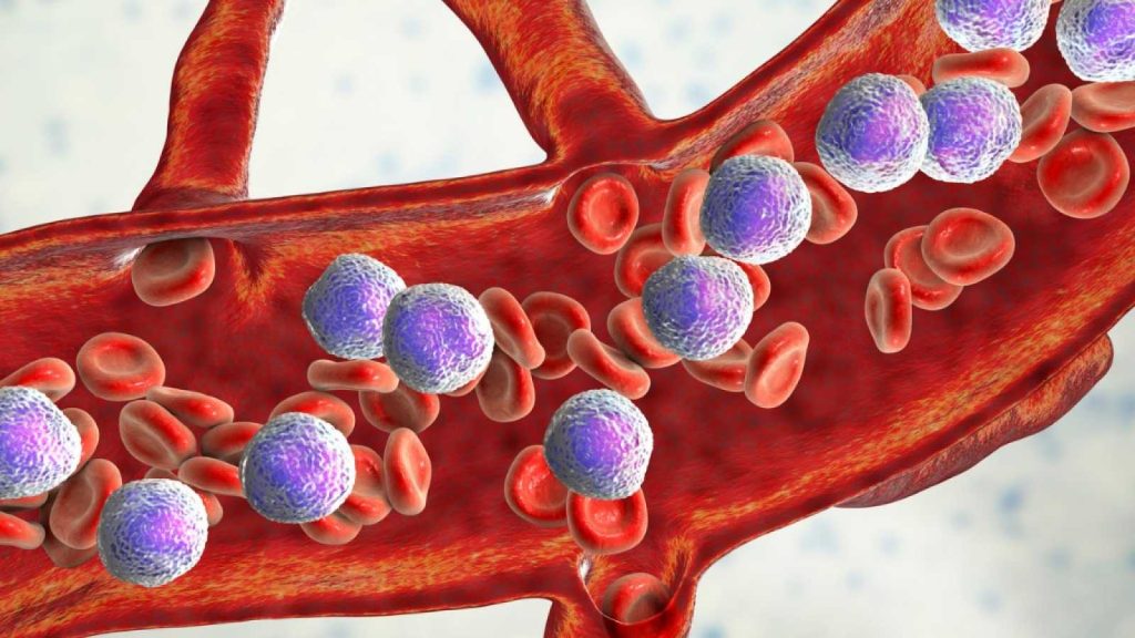 Τα ύποπτα συμπτώματα του λεμφώματος που δεν πρέπει να αγνοήσετε