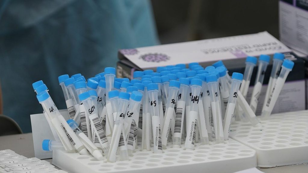 Καθηγητής Τζανάκης: «Για πρώτη φορά μετά από καιρό στο 5% ο δείκτης θετικότητας»