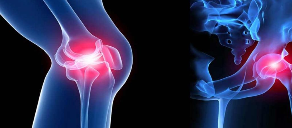 Πόνος στις αρθρώσεις: Οι 7+1 τροφές που πρέπει να αποφεύγετε