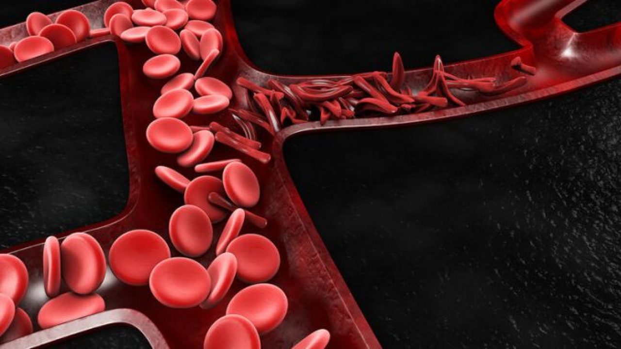 Κακή κυκλοφορία αίματος: Τα συμπτώματα που χρειάζονται προσοχή