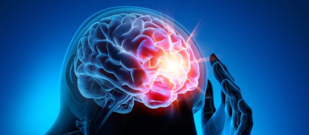Εγκεφαλικό: Αυτές είναι οι 4 κινήσεις που θα πρέπει να κάνετε και ίσως σας σώσουν