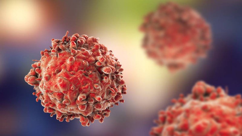 Κόψτε τη «μαχαίρι»: Η τροφή που πρέπει να σταματήσετε άμεσα για να «πολεμήσετε» τον καρκίνο