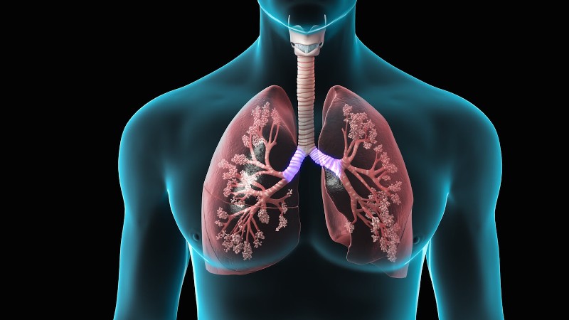 Καρκίνος του πνεύμονα: Τα πιο κοινά συμπτώματα που σας προειδοποιούν