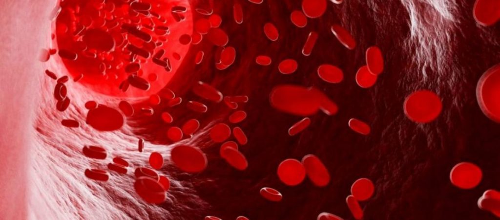 Τα σημάδια που δείχνουν ότι έχετε ανεπάρκεια σιδήρου