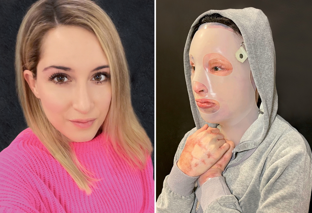 Επίθεση με βιτριόλι: Ικανοποιημένη η άτυχη Ιωάννα από το κατηγορητήριο για την 35χρονη (βίντεο)