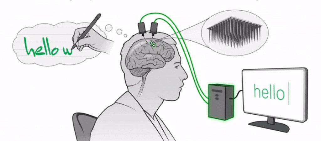 Σπουδαία δημιουργία – Το πρώτο «έξυπνο» χέρι προσφέρει τη δυνατότητα στους παράλυτους να «γράφουν»