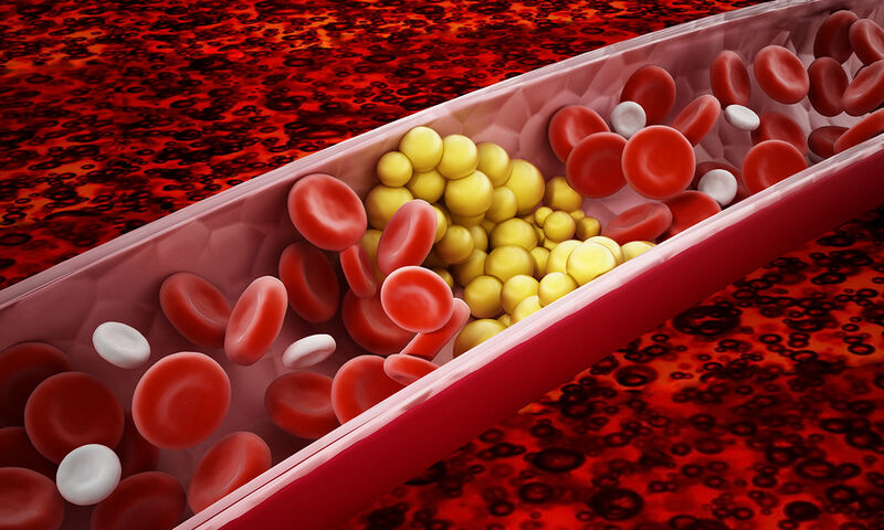 Έχετε χοληστερίνη; – Ποια τρόφιμα που την περιέχουν μπορείτε να τρώτε;