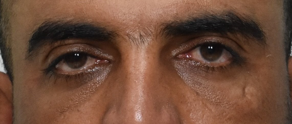 Στη δημοσιότητα τα στοιχεία και η φωτογραφία του Πακιστανού «Σάτυρου με το τζόκεϊ»