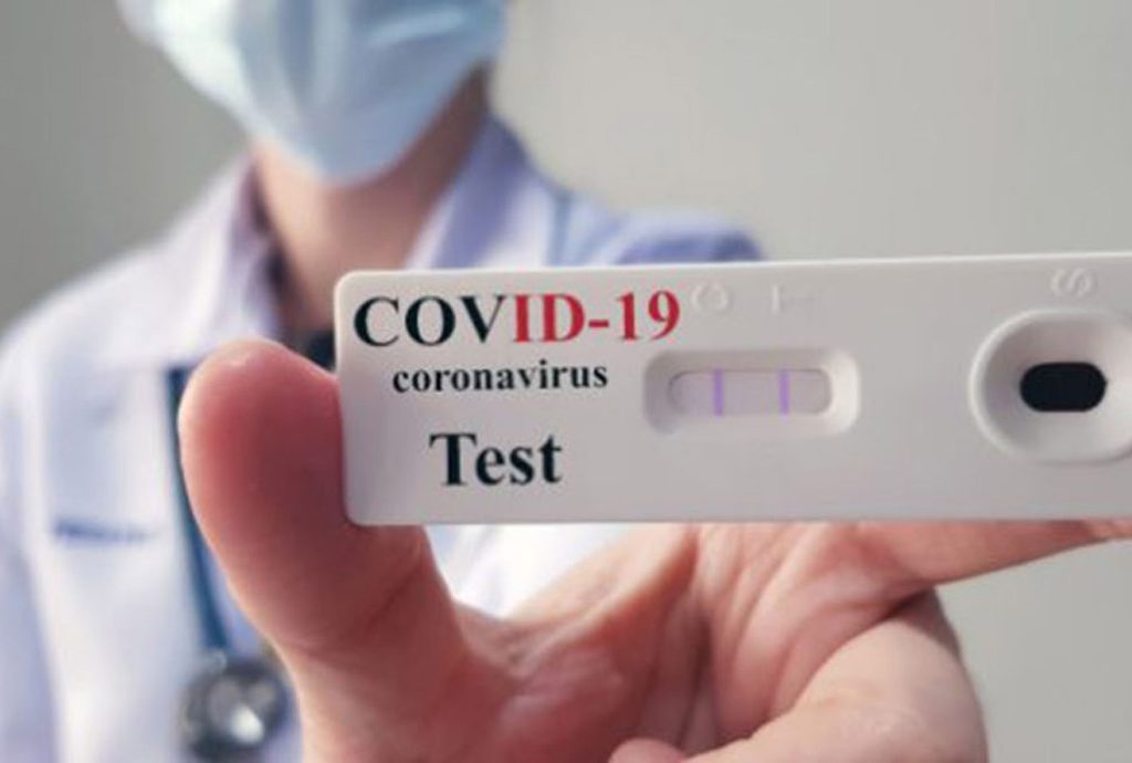 Δωρεάν rapid test σε όλες τις επιχειρήσεις της Αττικής – Τα σημεία ελέγχου