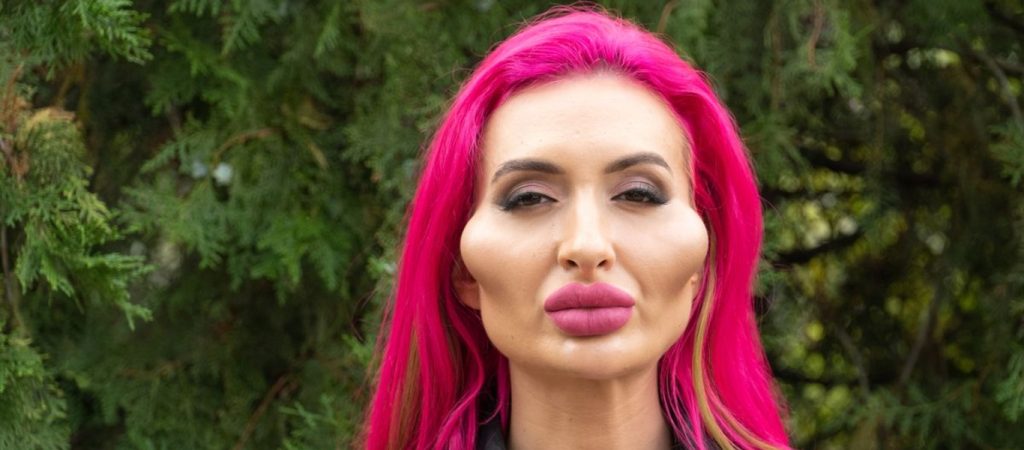 32χρονη από την Ουκρανία έχει πάθει εθισμό στις πλαστικές – Δεν έχει σκοπό να σταματήσει (φώτο)