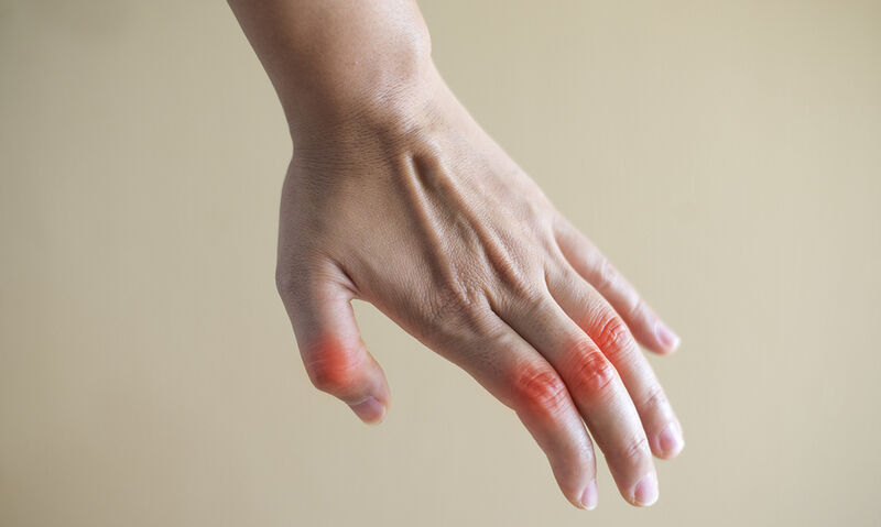 Κι όμως η θεραπεία της αρθρίτιδας βρέθηκε στη… φύση