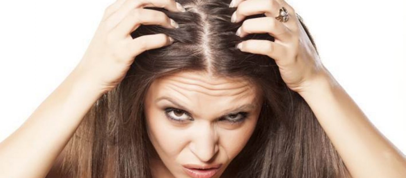 Πιτυρίδα: Δείτε πως θα την «εξαφανίσετε» με φυσικά υλικά που έχετε στο σπίτι