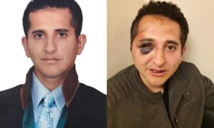 Τα αποτελέσματα της δράσης των σωματοφυλάκων του Ρ.Τ.Ερντογάν γιατί απλά ρώτησε για ποιον γίνονται όλα αυτά (βίντεο)