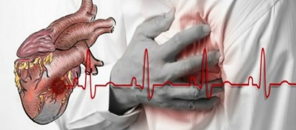 Έτσι θα ξεχωρίσετε την καρδιακή προσβολή από την καρδιακή ανακοπή
