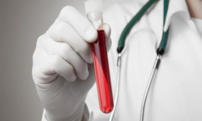 Χαμηλός αιματοκρίτης: Οι αιτίες που τον προκαλούν – Ποια είναι τα φυσιολογικά επίπεδα