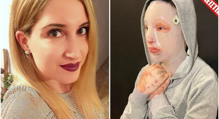 Η Ιωάννα που δέχθηκε επίθεση με βιτριόλι ξεσπά κατά του πιλότου – «Πότε θα ξυπνήσει η κοινωνία;» (φωτο)