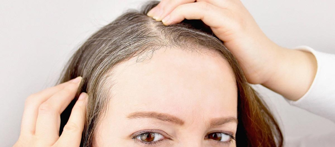 Τα γκρίζα μαλλιά που  σχετίζονται με το άγχος μπορούν να επανέλθουν στο φυσικό τους χρώμα