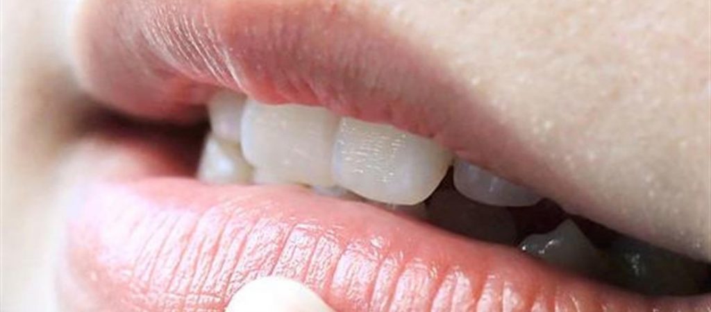 Νέα Ζηλανδία: Πανεπιστήμιο παρουσίασε συσκευή που εμποδίζει το στόμα να ανοίγει πάνω από 2 χιλιοστά (φώτο)