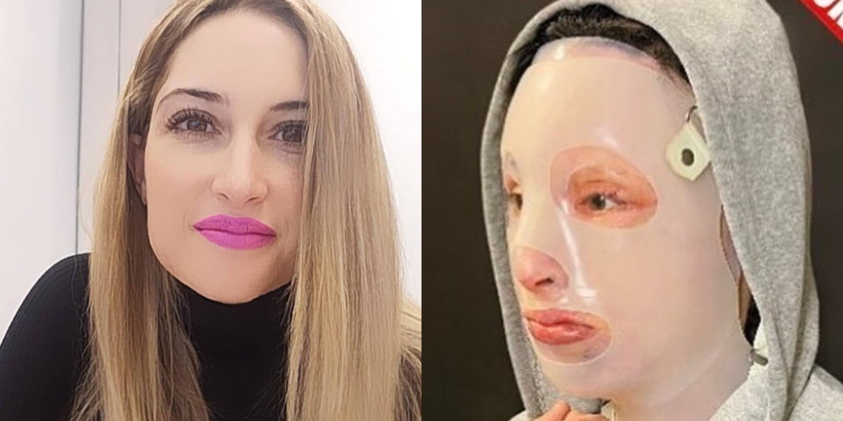 Επίθεση με βιτριόλι – Ιωάννα: «Επίπονο… αλλά θα πάω στο δικαστήριο»