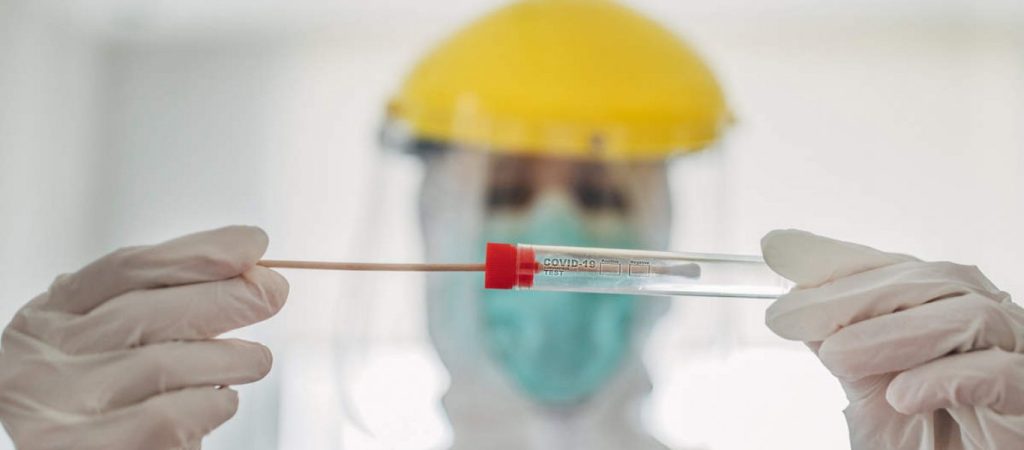 Δείτε σε ποιες περιοχές γίνονται σήμερα δωρεάν rapid test από τον ΕΟΔΥ