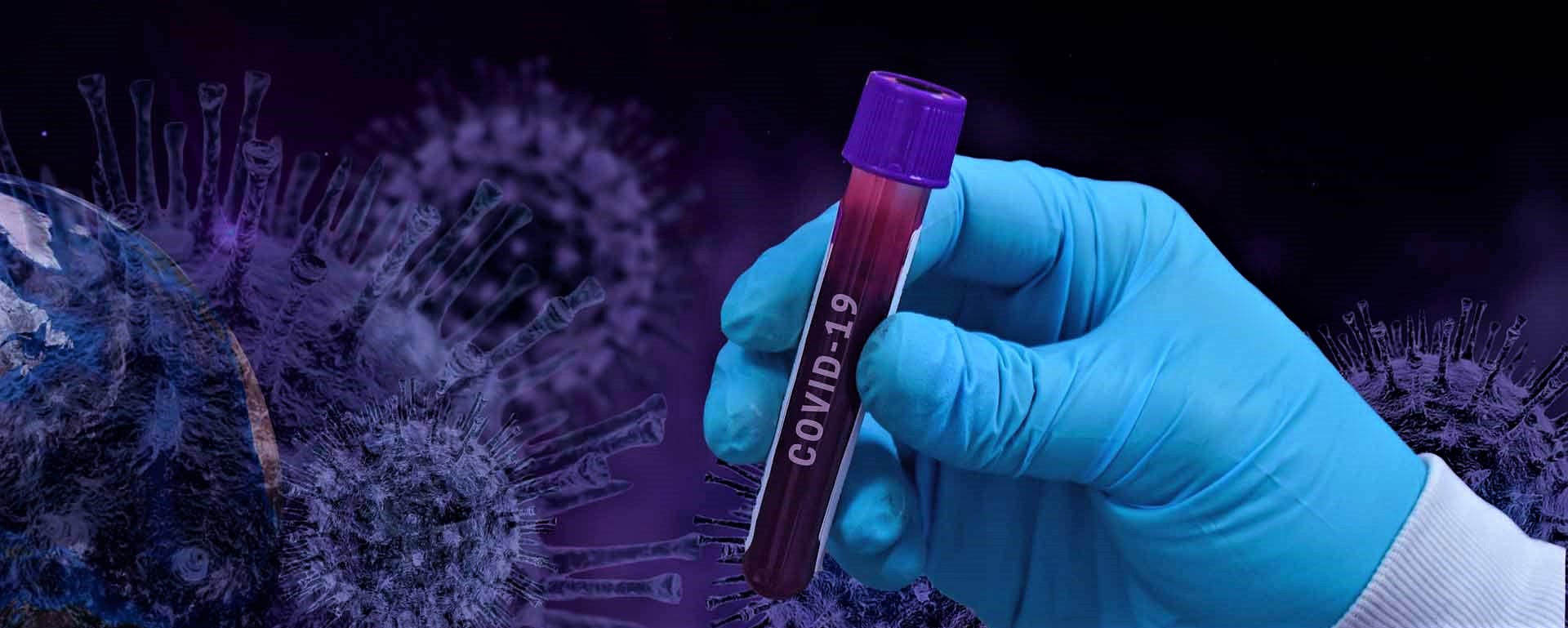 Σε εποχική γρίπη μετατρέπει τον Covid-19 η μετάλλαξη Δέλτα: Πολλά κρούσματα αλλά ελάχιστα θύματα & διασωληνωμένοι