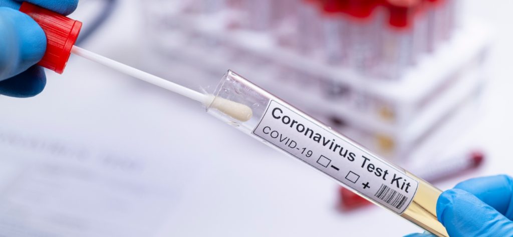 Δωρεάν και το καλοκαίρι τα τεστ κορωνοϊού στην Αυστρία – Τι ανακοίνωσε ο υπουργός Υγείας