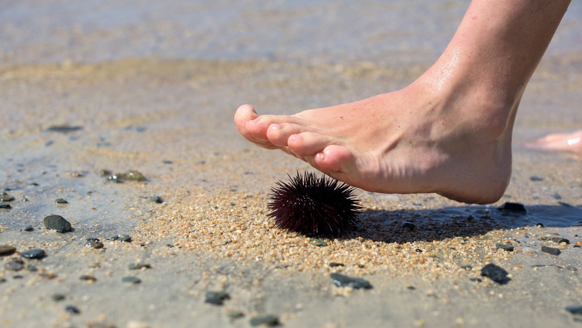 Προσοχή: Nα τι πρέπει να κάνετε αν πατήσετε αχινό