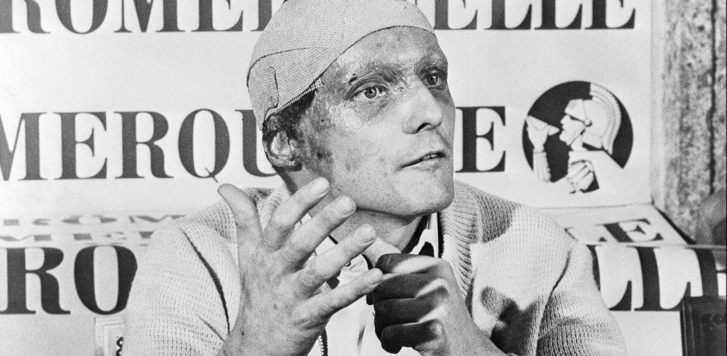 Σαν σήμερα, 1η Αυγούστου, ο αυστριακός οδηγός της Φόρμουλα1 Νίκι Λάουντα… προσπερνάει το θάνατο στο Νίρμπουργκρινγκ