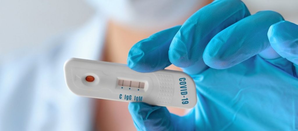 Στο «κυνήγι» οι εργαζόμενοι του ιδιωτικού τομέα από το κράτος: Βαριά πρόστιμα εάν δεν κάνουν διαγνωστικό τεστ!