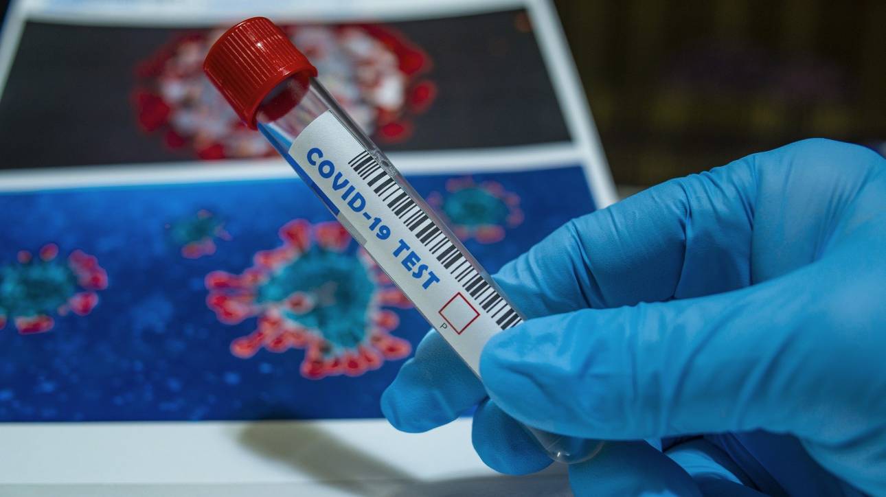 Η πρώτη ομολογία: Το Στάνφορντ ζητά υποχρεωτικό εβδομαδιαίο τεστ και για τους πλήρως εμβολιασμένους