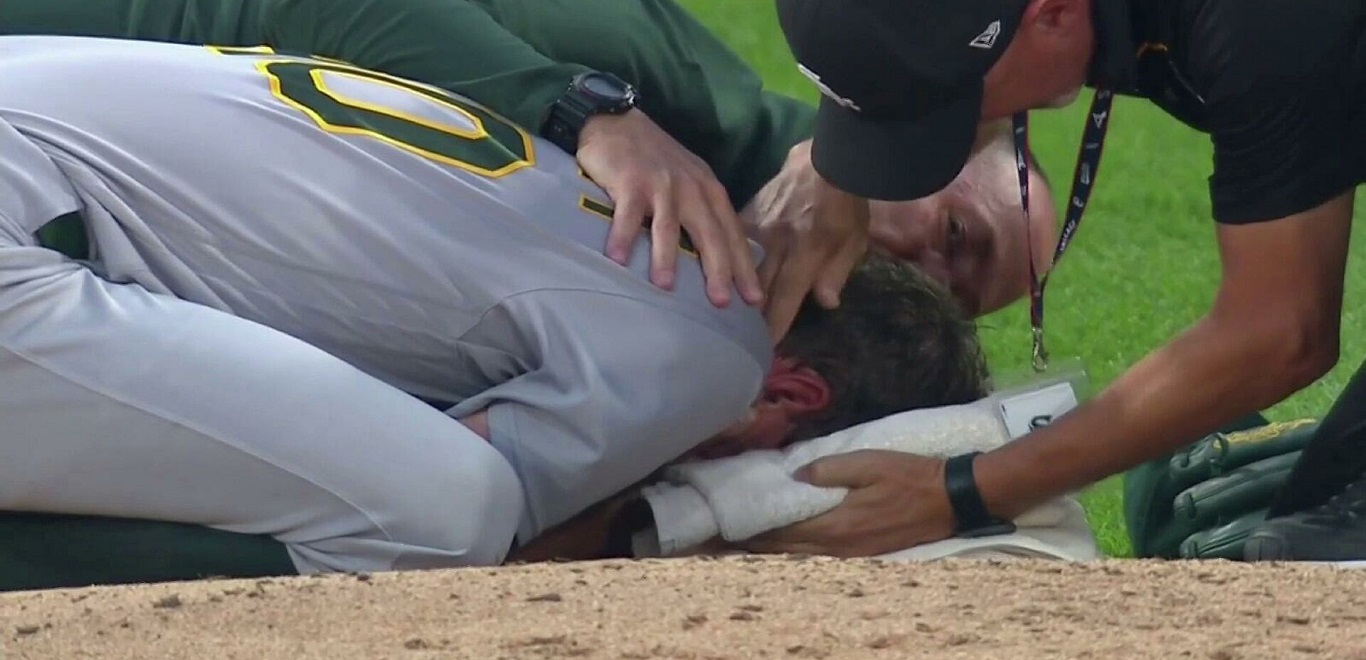 Παίκτης μπέιζμπολ τραυματίστηκε σοβαρά όταν τον πέτυχε το μπαλάκι στο πρόσωπο με ταχύτητα 160 χλμ! (βίντεο)