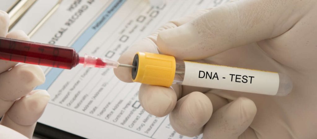 Το τεστ DNA που ξεκίνησε για πλάκα και κατέληξε σε… τραγωδία – Ανακάλυψε ότι το παιδί δεν ήταν δικό του